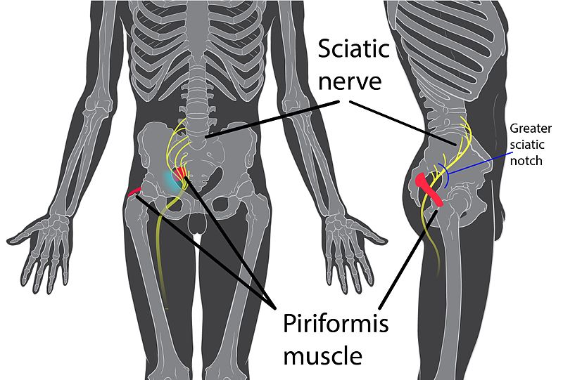Sitz des Piriformis-Muskels sowie Verlauf des Ischaisnervs (Sciatic nerve).