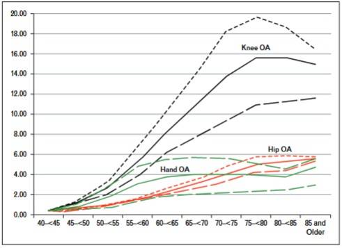 Alters- und geschlechtsspezifische Inzidenzraten (/1000 Personenjahre) von Kniearthrose (schwarz), Hüftarthrose (rot), und Handarthrose (grün). Durchgezogene Linie = Gesamtbevölkerung; kurze gestrichelte Linie ) Frauen; lange gestrichelte Linie = Männer. (Bildquelle: Allen & Golightly, 2015)